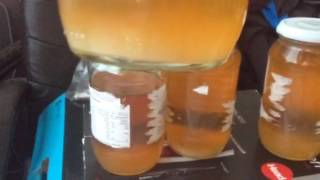 Sediment and Kidney Filtration Urine Samples [upl. by Uliram]