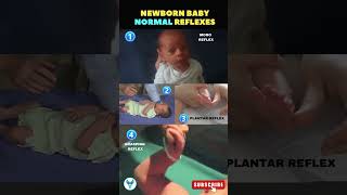 Newborn baby normal reflexes explained ✅ Moro reflex  Plantar reflex  Grasping reflex reflexes [upl. by Lenette488]