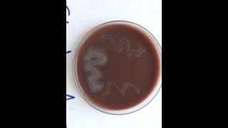 Unit 7  Supportive Selective and Differential Media  Chocolate Agar Medium [upl. by Cinom821]