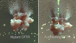 Cystic Fibrosis Mechanism and Treatment  HHMI BioInteractive Video [upl. by Ojadnama244]