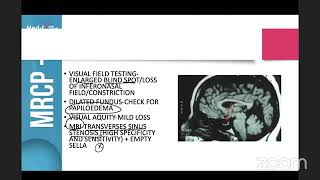 Free Webinar Alert Dr Moses MRCP1 August 2024 Recall Strategies [upl. by Eenhpad]