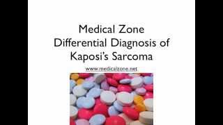 Medical Zone  Differential Diagnosis of Kaposis Sarcoma [upl. by Rodolfo]