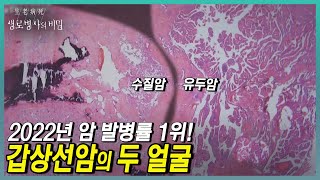 발병률 1위 갑상선암 하지만 관리는 소홀 ❌ 갑상선암을 무시하면 안 되는 이유 😲 애매하고 모호한 갑상선암에 대한 진실  KBS 231227 방송 [upl. by Torin632]