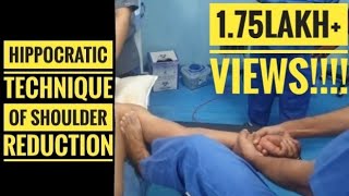 Hippocratic Method of Shoulder Reduction Reduction in less than 5seconds [upl. by Campos207]