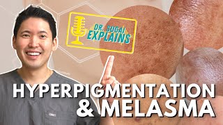 Dermatologist Explains Hyperpigmentation and Melasma  How to Manage it with Top Picks [upl. by Gaidano]