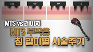 MTS 침길이별 효과 or 부작용  MTS 전문채널 NO1 MTS전도사 [upl. by Becky]