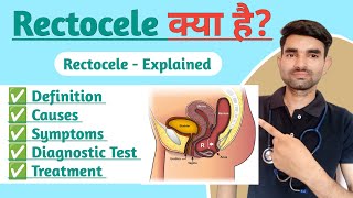 Rectocele Explained in Hindi  Causes Symptoms And Treatment of Rectocele [upl. by Akirdnas]