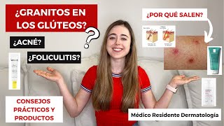 ¿GRANITOS EN LOS GLÚTEOS ¿FOLICULITIS ACNÉ GRANOS ¿POR QUÉ SALEN TIPS TRATAMIENTO PRODUCTOS [upl. by Arat]