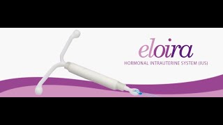 Eloira Loading amp Insertion Mechanism  Hormonal IUD [upl. by Cho445]