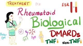 Rheumatoid Arthritis RA  Management  DMARDs  TNF  Rheumatology Series [upl. by Eisej]