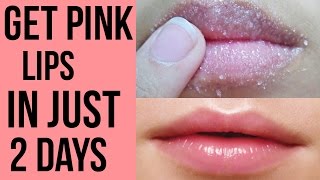 How to get pink lips Lighten dark lips naturally at home Get Rid Of Chapped Lips [upl. by Gati]