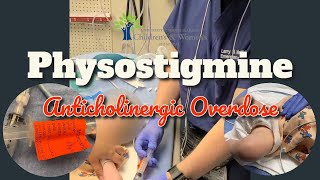 Physostigmine for Severe Doxylamine Overdose [upl. by Pulchi401]