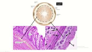 Figure of Enteric Nervous System Plexuses in histology slide of gut [upl. by Esertak]