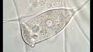 Vorticella sp in activated sludge [upl. by Kerwinn]