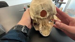 Skull Frontal Parietal and Occipital Bone and their bone markings [upl. by Natsirk]