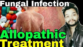 Fungal infection Allopathic Treatment In Hindi  Gyanear [upl. by Ornas]