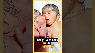 So beautiful😍 twins baby dono girl hai 😲Golu molu baby cute shorts newsong love [upl. by Orest]