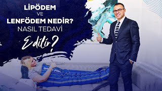 Lipödem ve Lenfödem Nedir Nasıl Tedavi Edilir  Prof Dr Mert Dumantepe [upl. by Ashby]