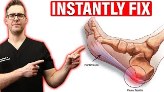 How To Cure Plantar Fasciitis FAST amp FOREVER Heel Pain amp Heel Spurs [upl. by Coleen]