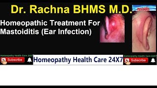 Homeopathy medicine for Mastoiditis [upl. by Four]