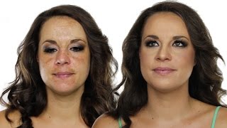 How To Cover Hyperpigmentation  Skin Pigmentation Using MakeUp  Shonagh Scott  ShowMe MakeUp [upl. by Merrili]