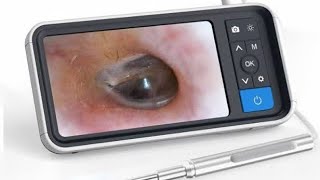 Otoscopio  endoscopio ótico WIFI RESEÑA Y UMBOXING ENDOSCOPE TOOL ANDROID [upl. by Adlemy201]