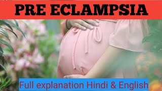 PRE ECLAMPSIA IMPORTANT NURSING VIEWSpreeclampsia lecture in Hindipreeclampsia symptoms [upl. by Halludba322]