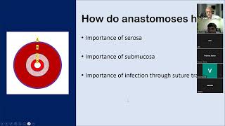 Anastomotic leak group discussion lakshman 231005 [upl. by Ayor504]