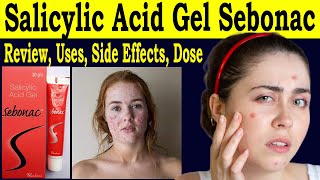 Salicylic Acid Gel Sebonac  Salicylic Acid Gel Review  uses Side Effects Dose How to use [upl. by Narcho]