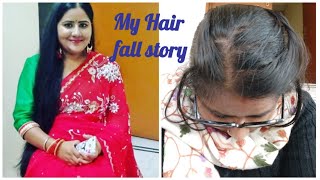 My hair loss storyTelogen effluviumExcess Hair fallHair careHair fall treatment [upl. by Heer]