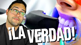 ¡LO QUE NADIE TE DICE 🚫 DEL BLANQUEAMIENTO DENTAL 💔 Deberías ver este vídeo 👀 [upl. by Misak]