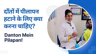 Danton Mein Pilapan  दाँतों में पीलापन  दाँतों में पीलापन हटाने के लिए क्या करना चाहिए [upl. by Nyliahs148]