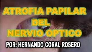 ATROFIA PAPILAR DEL NERVIO ÓPTICO  DEGENERACIÓN DEL NERVIO [upl. by Notserp]