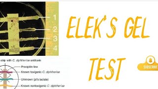 ELEKS GEL TEST [upl. by Taite]