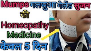 Mumps  गलसुआ  homeopathc medicin for mumps diseases [upl. by Matthieu]