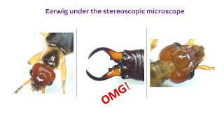 Earwig under the microscope [upl. by Dachia]