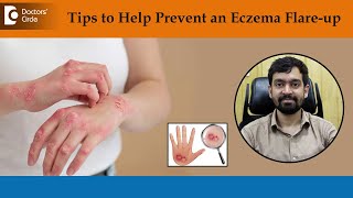 What Causes Eczema to Flare Up How to Treat amp Get Rid of EczemaDrRajdeep Mysore Doctors Circle [upl. by Dong]