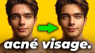 ❌ BOUTONS D’ACNÉ VISAGE  Comment en Finir Définitivement ✅ [upl. by Scrivenor]