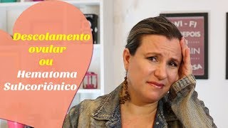 HEMATOMA SUBCORIÔNICO ou DESCOLAMENTO OVULAR  Monica Romeiro [upl. by Washko]