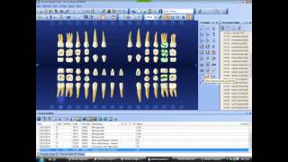 new pt in dentrix chart [upl. by Haeli]