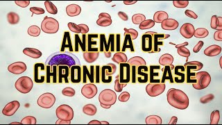 Anemia of Chronic Disease updated 2021  CRASH Medical Review Series [upl. by Ferdy729]