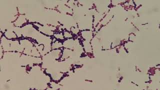 Gram positive bacteria becoming Negative [upl. by Ettevi]