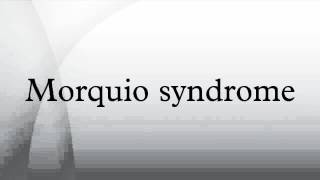 Morquio syndrome [upl. by Aniraad]