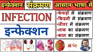 Part 2 Chain Of Infection Explain in Hindi  Microbiology  BScNursing  medical [upl. by Bellanca713]