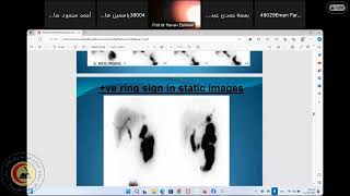 06 Nuclear Medicine 32 RES Egypatian Fellowship Dr Hanan ElAhwal [upl. by Ayifas]