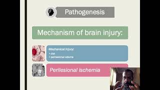 intracerebral hemorrhage [upl. by Anile]