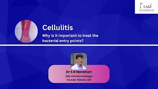 Cellulitis Treatment of bacterial entry points  Dr S R Narahari  Institute of Applied Dermatology [upl. by Ataeb504]