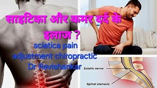 Sciatica pain ke Treatment  साइटिका दर्द के इलाज trending shorts viralvideo [upl. by Merrie]