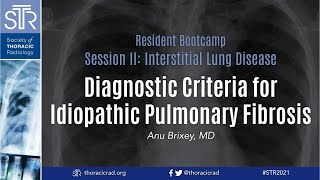 Diagnostic Criteria for Idiopathic Pulmonary Fibrosis [upl. by Flodnar278]