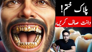 Dr ZeeTop Remedy To get rid of Dental Plaque TARTAR  डॉक्टर ज़ी [upl. by Trillbee]